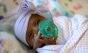 Saybie, o menor bebê do mundo / Foto: Hospital Sharp Mary Birch